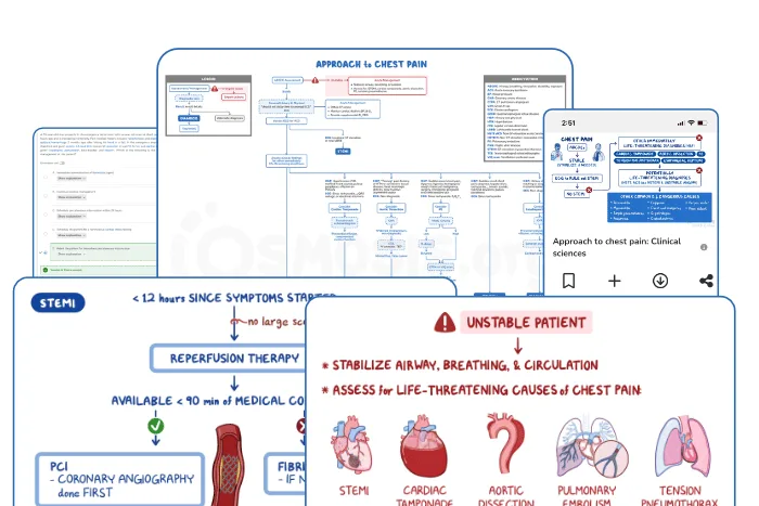 Illustration showing Osmosis features for the approach to chest pain